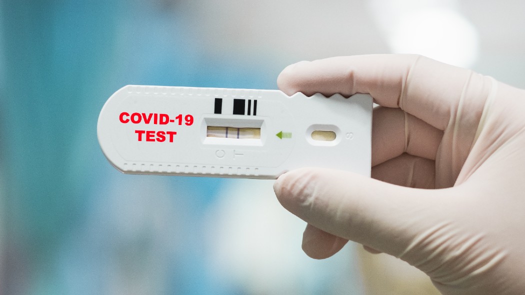 benevento-test-rapido-coronavirus-saliva-università-sannio